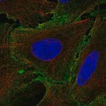 Merck Anti-IL12RB1 antibody produced in rabbit