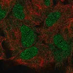 Merck Anti-HOXB5 antibody produced in rabbit
