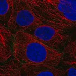 Merck Anti-GJB3 antibody produced in rabbit