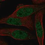 Merck Anti-RAB8B antibody produced in rabbit