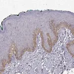 Merck Anti-TACR1 antibody produced in rabbit