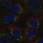 Merck Anti-ATP7B antibody produced in rabbit
