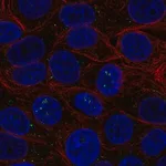 Merck Anti-BAMBI antibody produced in rabbit