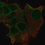Merck Anti-TRAK1 antibody produced in rabbit