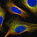 Merck Anti-FBXO30 antibody produced in rabbit