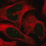 Merck Anti-CBX4 antibody produced in rabbit
