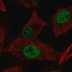 Merck Anti-MGAT5B antibody produced in rabbit