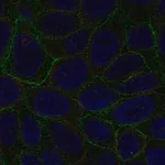 Merck Anti-LGALS8 antibody produced in rabbit