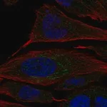 Merck Anti-CHST2 antibody produced in rabbit