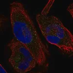 Merck Anti-KCNH1 antibody produced in rabbit