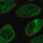 Merck Anti-NEFL antibody produced in rabbit