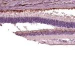 Merck Anti-TRPM1 antibody produced in rabbit