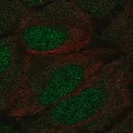 Merck Anti-DCLK1 antibody produced in rabbit
