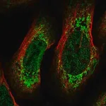 Merck Anti-CREB3L2 antibody produced in rabbit
