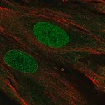 Merck Anti-PHF11 antibody produced in rabbit
