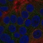 Merck Anti-TOB2 antibody produced in rabbit