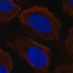 Merck Anti-PRRT2 antibody produced in rabbit