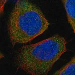 Merck Anti-WARS antibody produced in rabbit