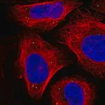 Merck Anti-SEMA3A antibody produced in rabbit