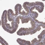 Merck Anti-MANBAL antibody produced in rabbit
