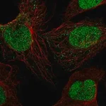 Merck Anti-SIRT1 antibody produced in rabbit