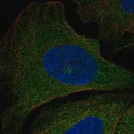 Merck Anti-PIK3R5 antibody produced in rabbit