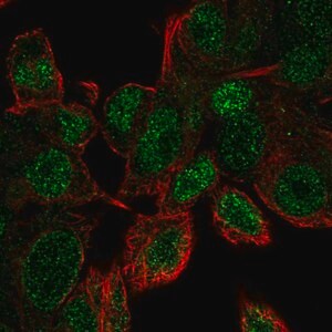 Merck Anti-UBE2V1 antibody produced in rabbit