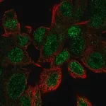 Merck Anti-UBE2V1 antibody produced in rabbit