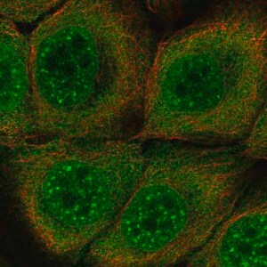 Merck Anti-SERPINB13 antibody produced in rabbit