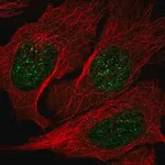 Merck Anti-NME3 antibody produced in rabbit