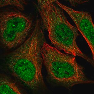 Merck Anti-MAGEA11 antibody produced in rabbit