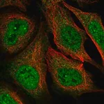 Merck Anti-MAGEA11 antibody produced in rabbit