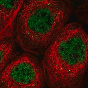 Merck Anti-SOS2 antibody produced in rabbit