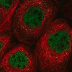 Merck Anti-SOS2 antibody produced in rabbit