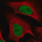 Merck Anti-MCM5 antibody produced in rabbit