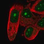 Merck Anti-DFFB antibody produced in rabbit