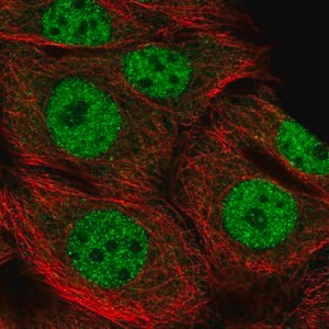 Merck Anti-RBBP8 antibody produced in rabbit