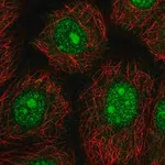 Merck Anti-NARF antibody produced in rabbit