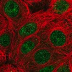 Merck Anti-PARG antibody produced in rabbit