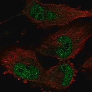 Merck Anti-TATDN1 antibody produced in rabbit