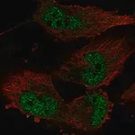 Merck Anti-TATDN1 antibody produced in rabbit