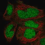 Merck Anti-ZNF331 antibody produced in rabbit