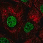 Merck Anti-BNC1 antibody produced in rabbit