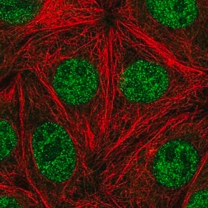 Merck Anti-FANCA antibody produced in rabbit