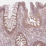 Merck Anti-MAP3K5 antibody produced in rabbit