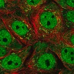 Merck Anti-SERTAD1 antibody produced in rabbit