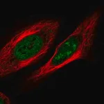 Merck Anti-ZNF554 antibody produced in rabbit