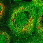 Merck Anti-PLEKHG3 antibody produced in rabbit