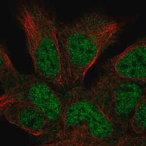 Merck Anti-HUS1B antibody produced in rabbit