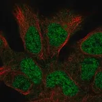 Merck Anti-HUS1B antibody produced in rabbit